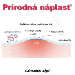 Prírodná náplasť na rýchle odstránenie akné