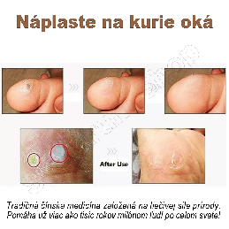 Náplaste na odstránenie kurieho oka_S_6.jpg