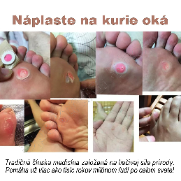 Náplaste na odstránenie kurieho oka_S_7.jpg