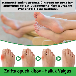 Prírodná náplasť na Hallux Valgus - vybočení palec 5ks